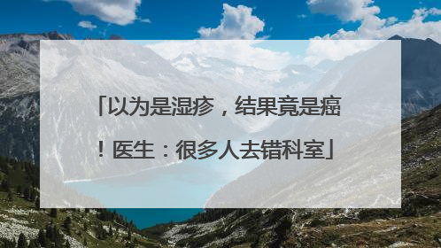 以为是湿疹，结果竟是癌！医生：很多人去错科室